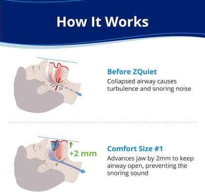 ZQuiet™ - Antisoplo Confortable para Sueños Tranquilos™ - novio™