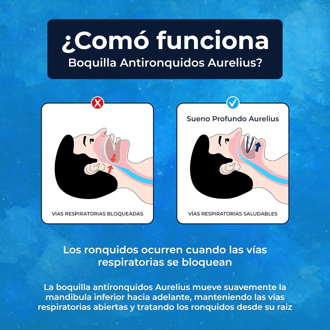 ZQuiet™ - Antisoplo Confortable para Sueños Tranquilos™ - novio™